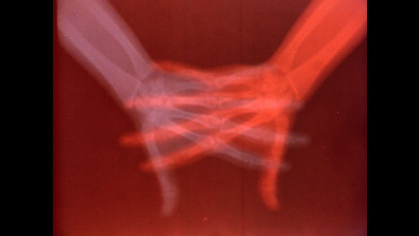 Poster: Overexposed: Art, Technology, and the Body